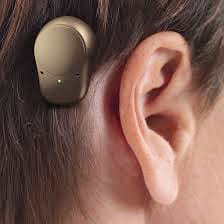 Implante Auditivo por vía ósea